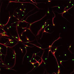 Human cortical neurons in culture