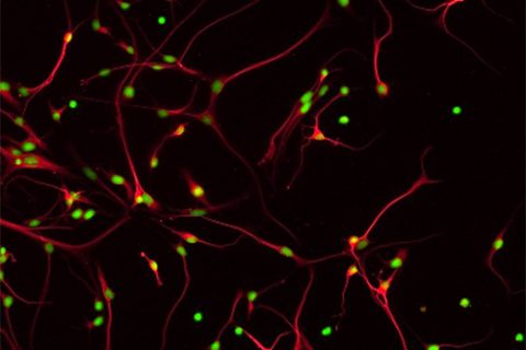 Human cortical neurons in culture