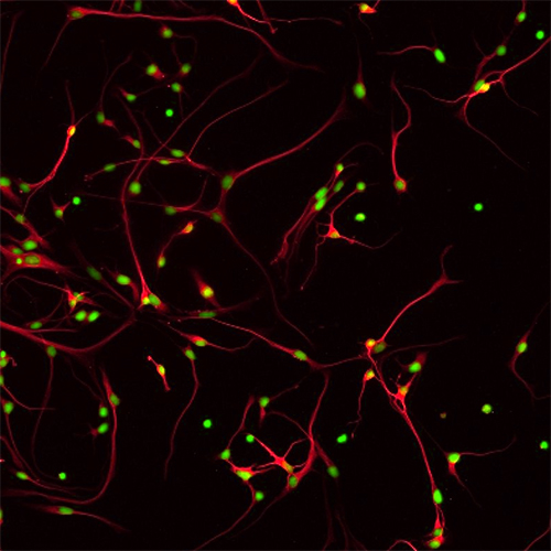 Human cortical neurons in culture