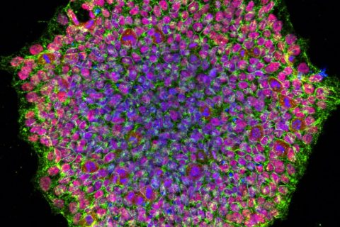iPSC-derived neuronal cells