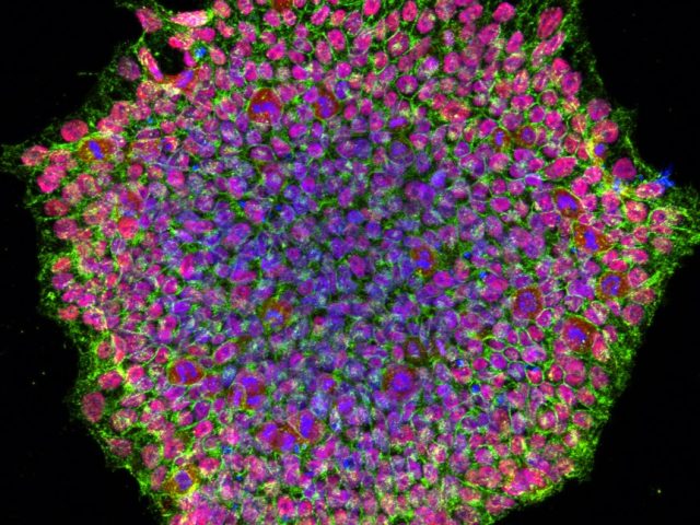 Human iPSC - Motor Neurons