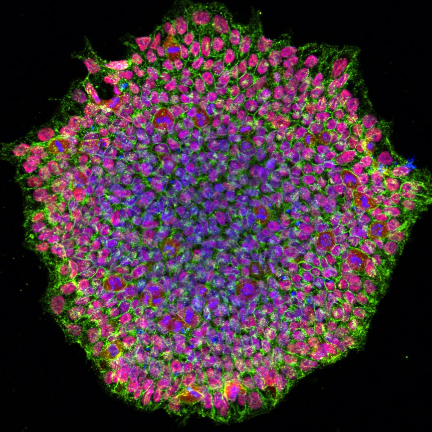 Human iPSC - Motor Neurons